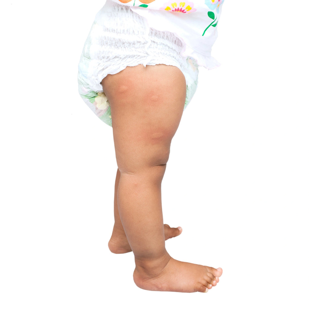 Traitement anti punaises pour chambre de bébé, enfant et maman enceinte